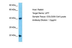 lipoyltransferase 1 Rabbit anti-Human, Polyclonal, Novus Biologicals 0.1 mL | Buy Online | Novus Biologicals | Fisher Scientific